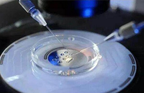 试管囊胚等级怎么提升？