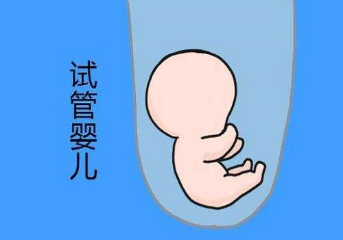 2021什么情况下要做三代试管婴儿？