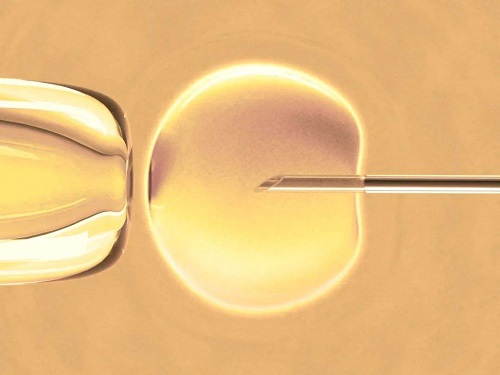 解惑：美国试管会不会导致胎儿宫内发育迟缓？